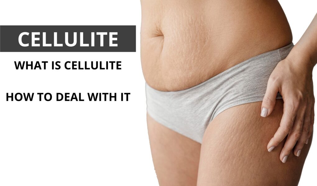 5 Easy Facts About How To Get Rid Of Cellulite (Cellulite Treatment Methods) Explained thumbnail